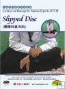 Lectures on Massage by Famous Experts of TCM-Slipped Disc
