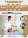 Alopecia Areata And Toothache,Chinese Massage DVD, English Subtitled