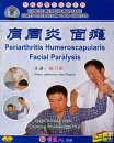 Periarthritis Humeroscapularis & Facial Paralysis, DVD